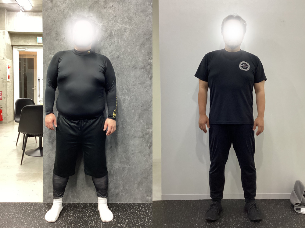 I様ビフォーアフター　前面